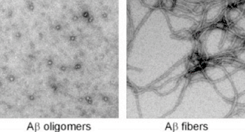 Imagen: Estructuras moleculares de los oligómeros de amiloide y de las fibras amiloideas (Fotografía cortesía de la Universidad de California, Los Angeles).